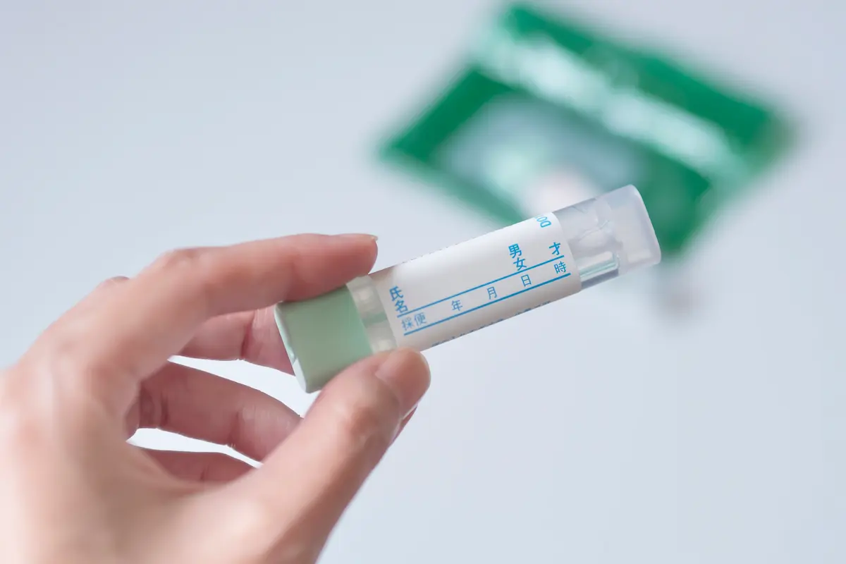 郵送検査と来院検査の違いとは？それぞれのメリット・デメリットを比較